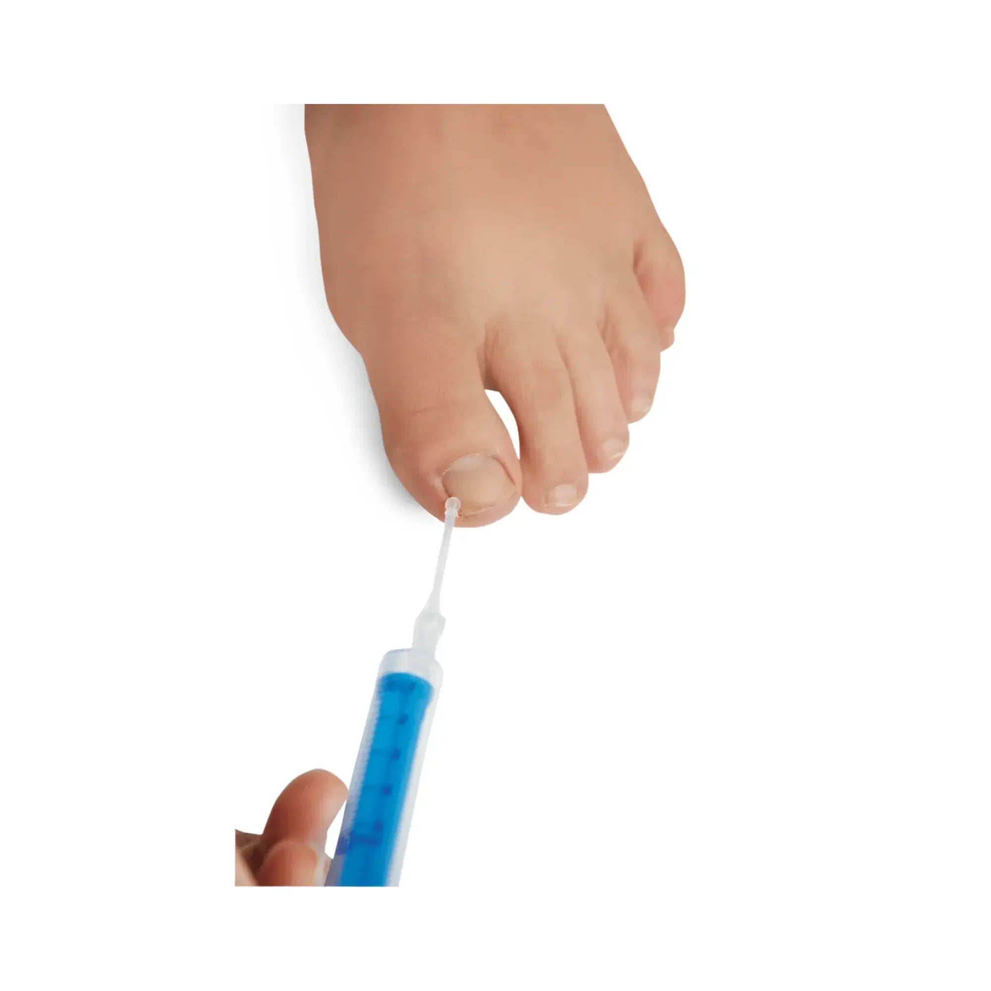 Canule bouton jetable stérile - Ruck Ruck