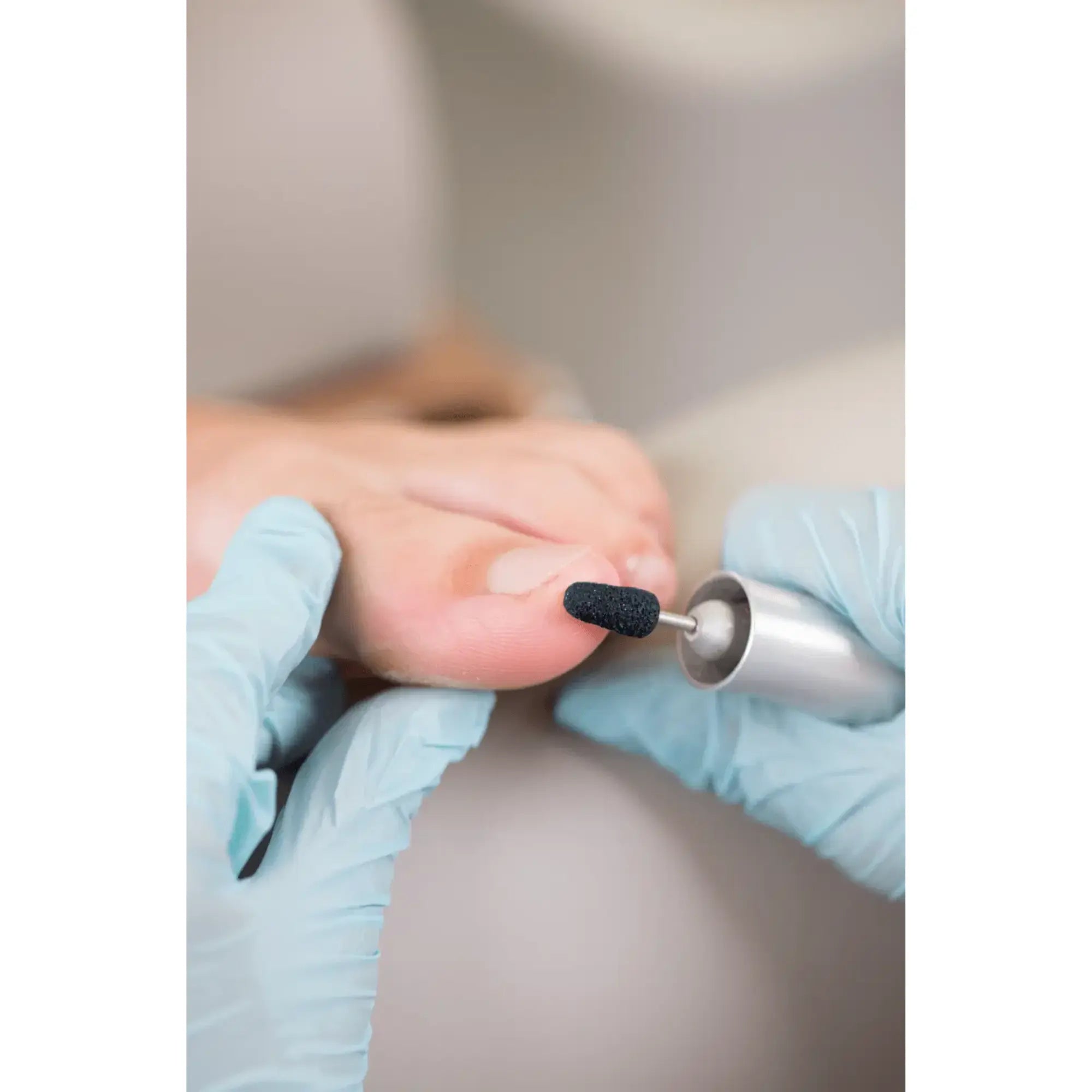 Capuchons abrasifs coniques x10 1502 - Diamant - Grain moyen - Abrasion des cors, durillons et hyperkératoses - 5 mm Ruck