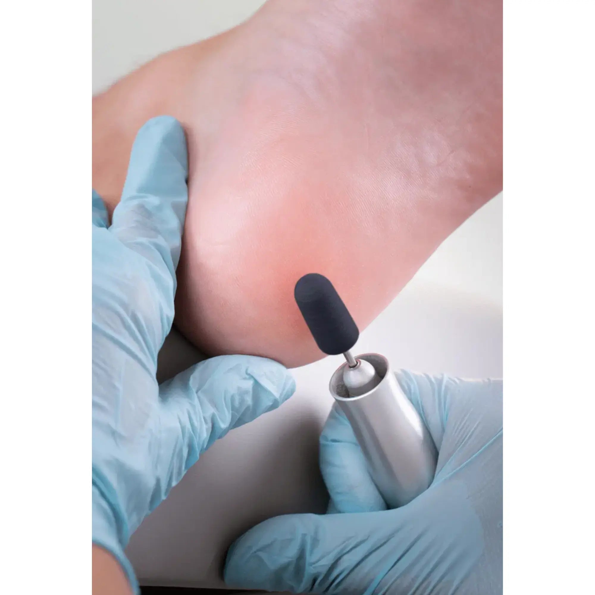 Capuchons abrasifs coniques x10 1602 - Diamant - Grain moyen - Abrasion des cors, durillons et hyperkératoses - 11 mm Ruck