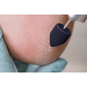 Capuchons abrasifs pointus x10 1004 - Diamant - Grain super gros - Abrasion des cors, durillons et hyperkératoses - 10 mm Ruck