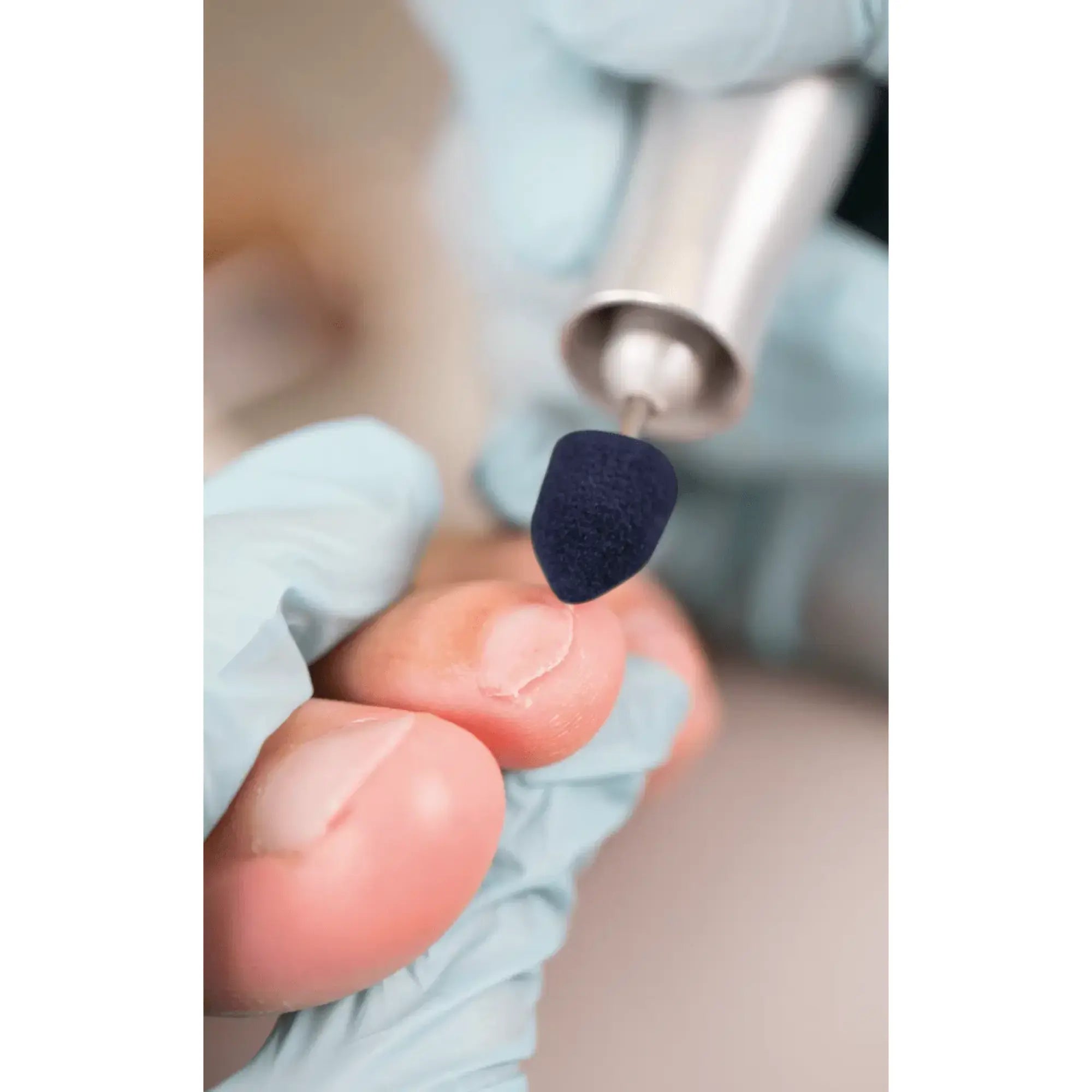 Capuchons abrasifs pointus x10 1004 - Diamant - Grain super gros - Abrasion des cors, durillons et hyperkératoses - 10 mm Ruck