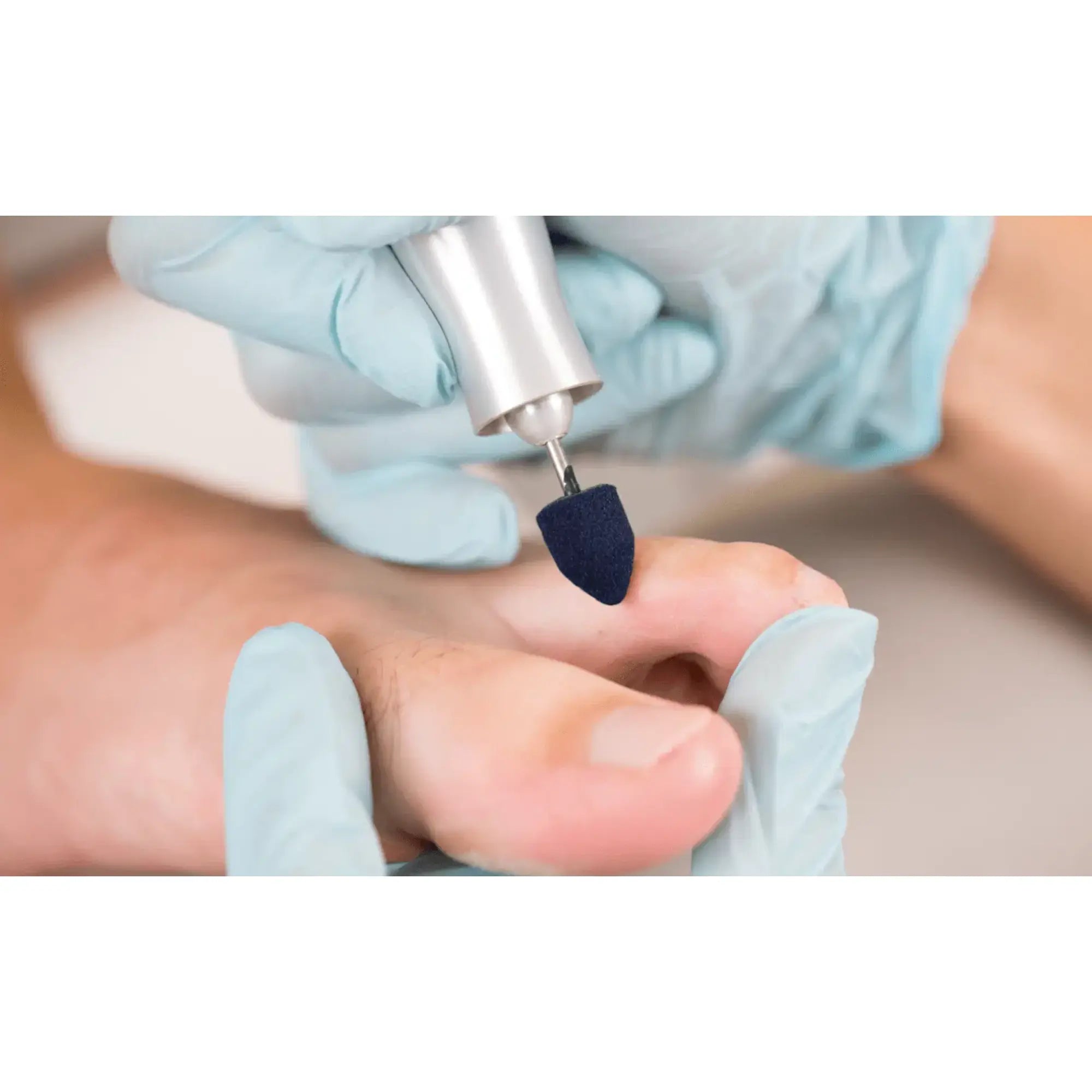 Capuchons abrasifs pointus x10 1103 - Diamant - Grain gros - Abrasion des cors, durillons et hyperkératoses - 13 mm Ruck