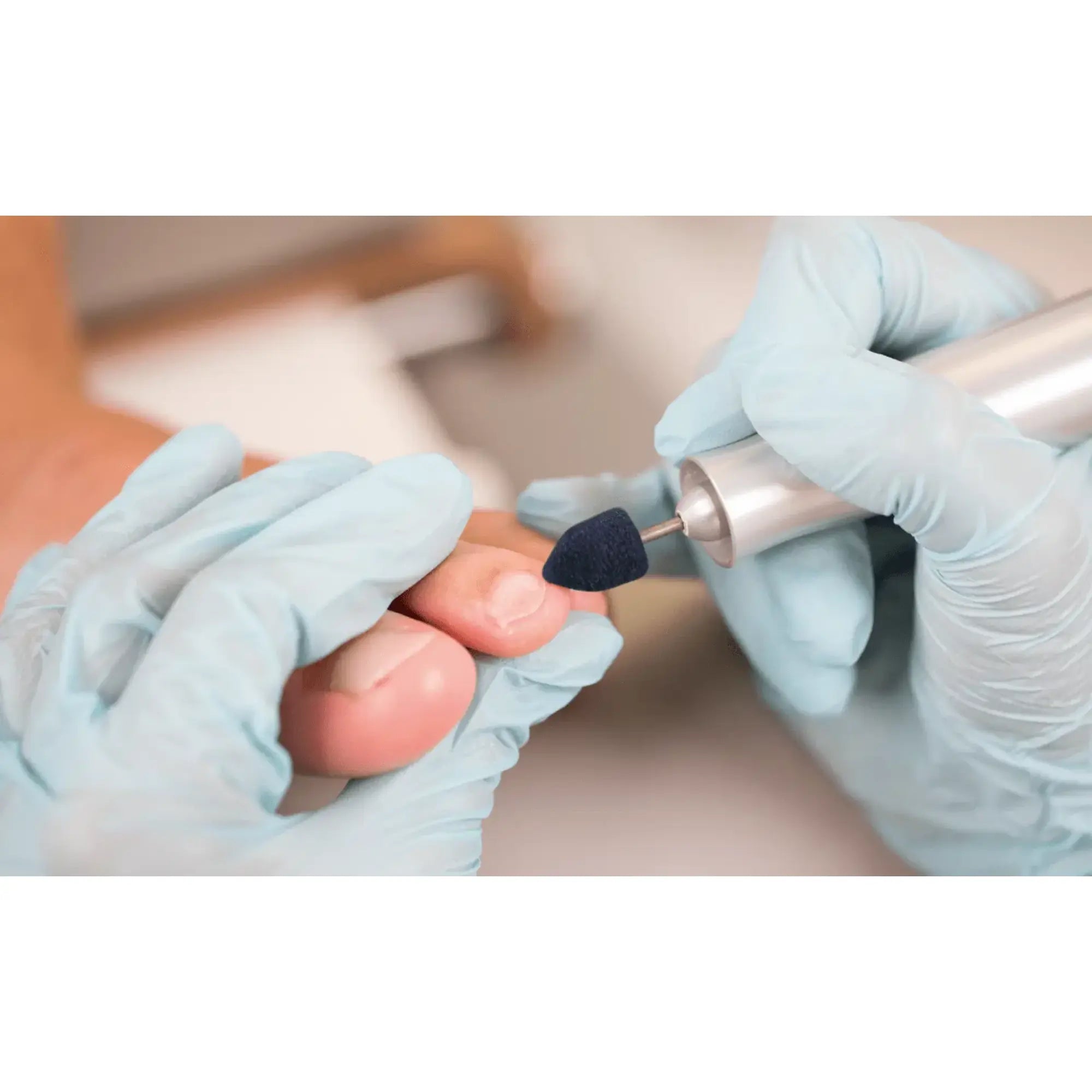 Capuchons abrasifs pointus x10 1103 - Diamant - Grain gros - Abrasion des cors, durillons et hyperkératoses - 13 mm Ruck