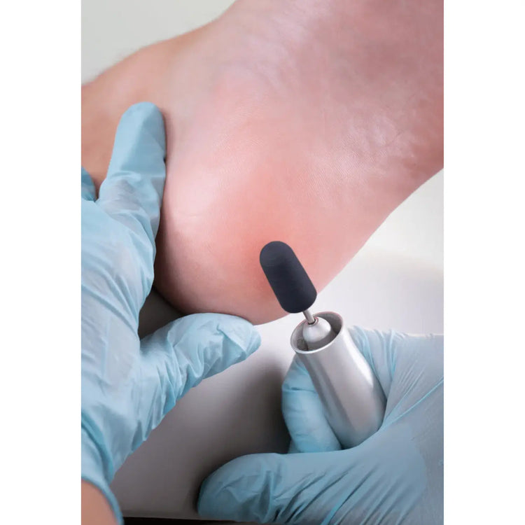 Capuchons abrasifs ronds x10 0503 - Diamant - Grain gros - Abrasion des cors, durillons et hyperkératoses - 13 mm Ruck