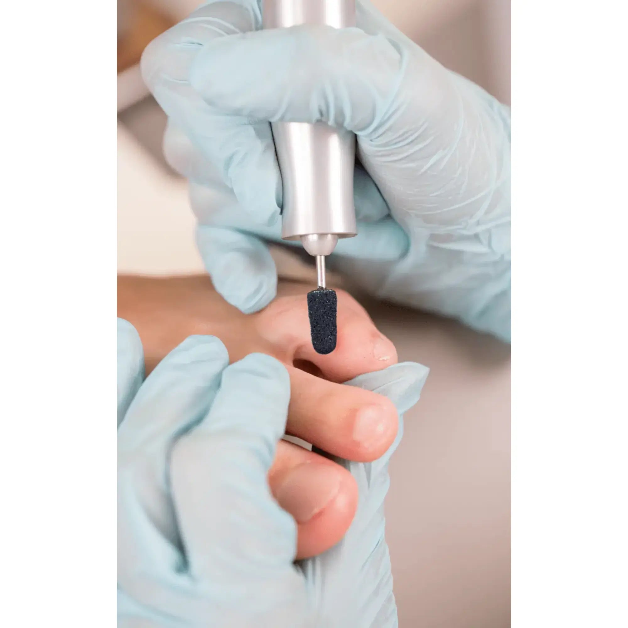 Capuchons abrasifs ronds x10 0504 - Diamant - Grain super gros - Abrasion des cors, durillons et hyperkératoses - 13 mm Ruck