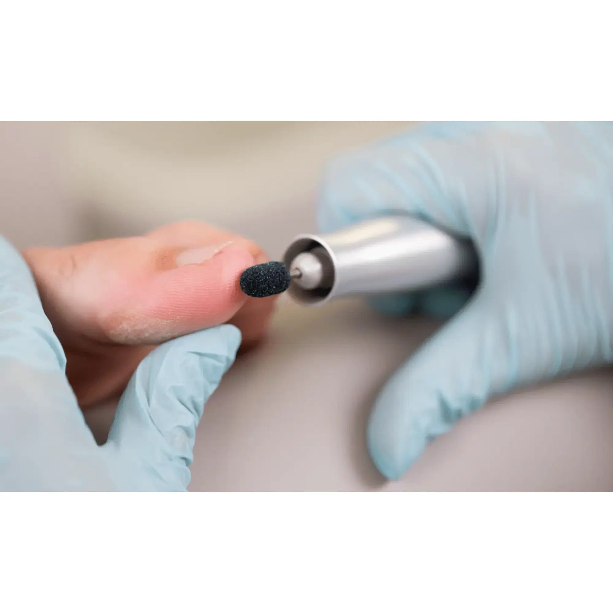 Capuchons abrasifs ronds x10 0904 - Diamant - Grain super gros - Abrasion des cors, durillons et hyperkératoses - 16 mm Ruck