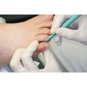 Curette cutanée - Longueur : 15 cm - Ruck Ruck
