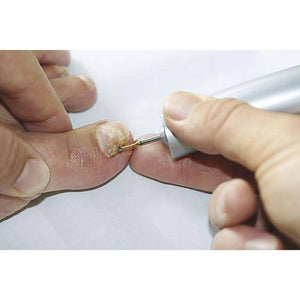 Fraise 1SXM Carbure de tungstène - Enucléation des cors - 1,8 mm - My Podologie