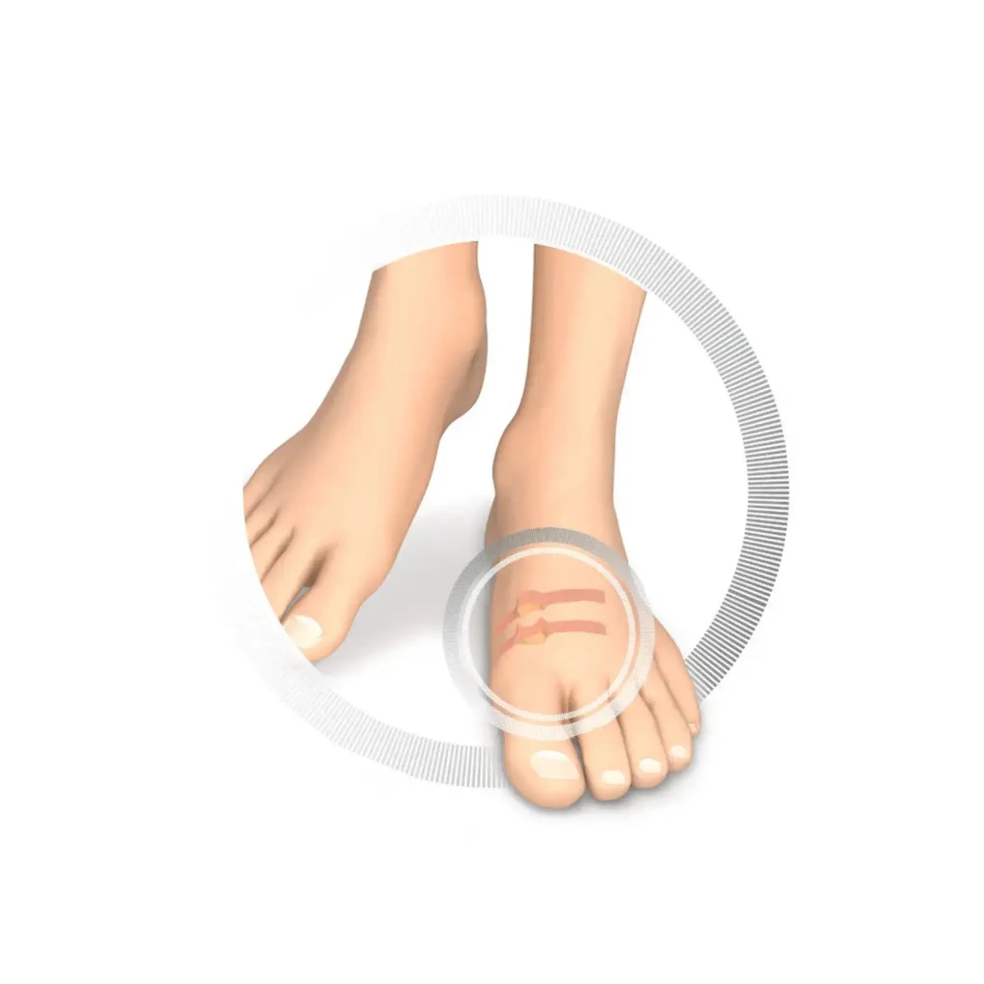 Protection pour orteils - Coussin creusé en latex souple - Protège contre la friction - 9 pièces - Ruck Ruck