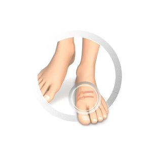 Protection pour orteils - Coussin creusé en latex souple - Protège contre la friction - 9 pièces - Ruck Ruck