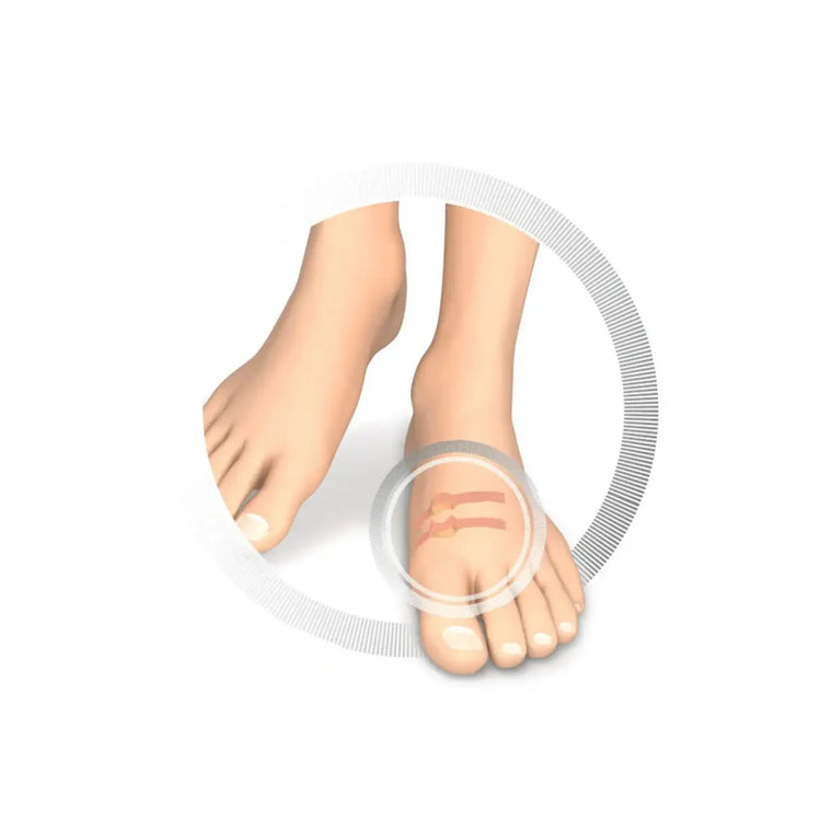 Protection pour orteils - Coussin creusé en latex souple - Protège contre la friction - 9 pièces - Ruck Ruck