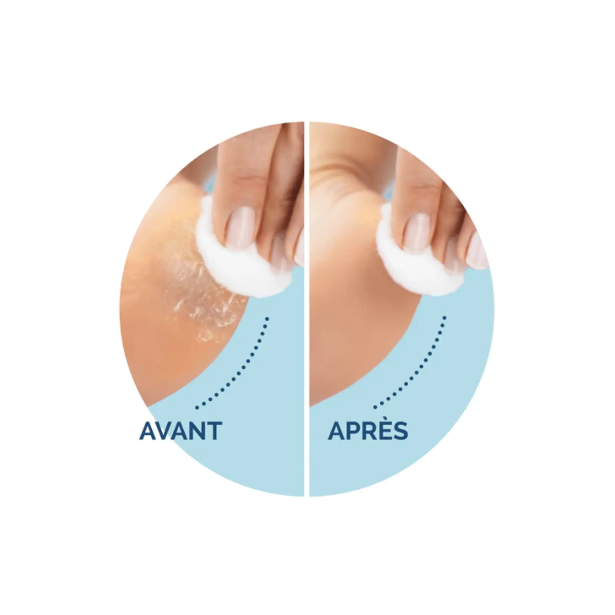 Recharge Rouleau Grain Ultra-Exfoliant - Râpe de Pédicurie Électrique - Velvet Smooth - Scholl Scholl