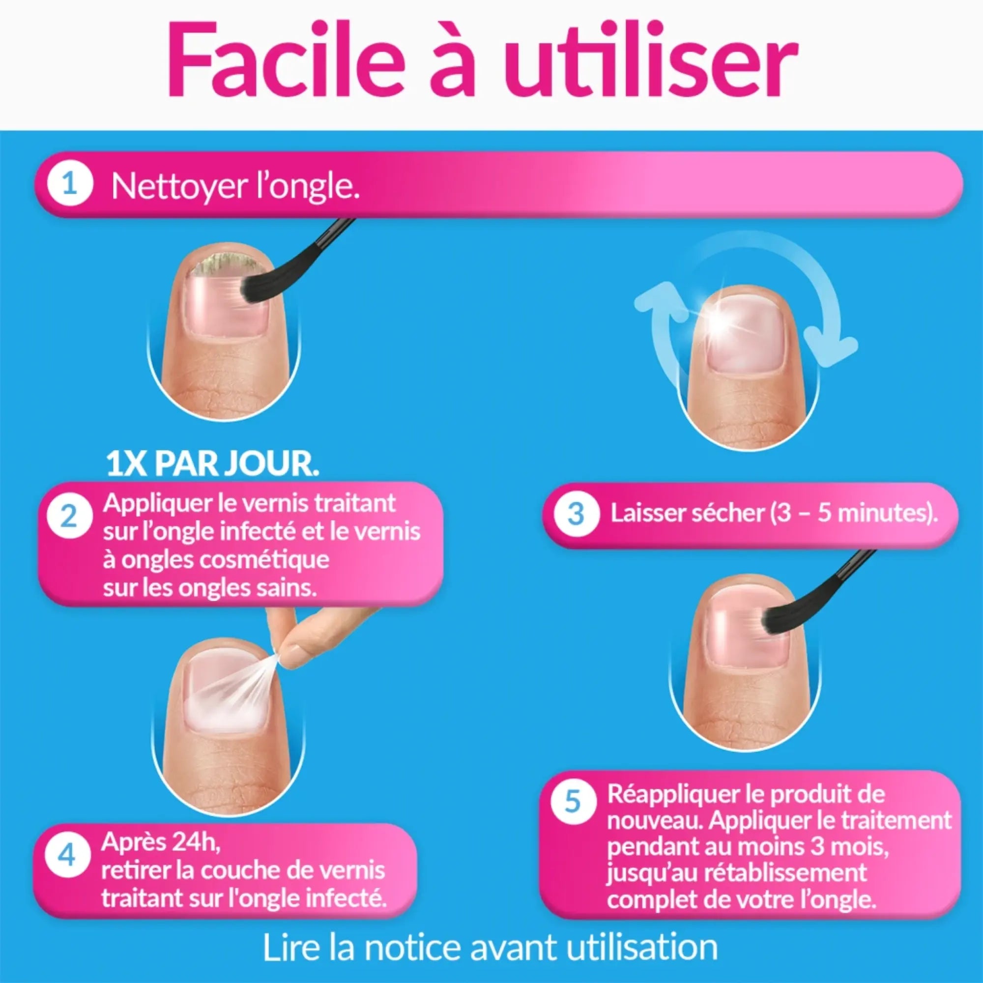 Traitement mycose ongles forte couleur nude 30ml - Excilor Excilor