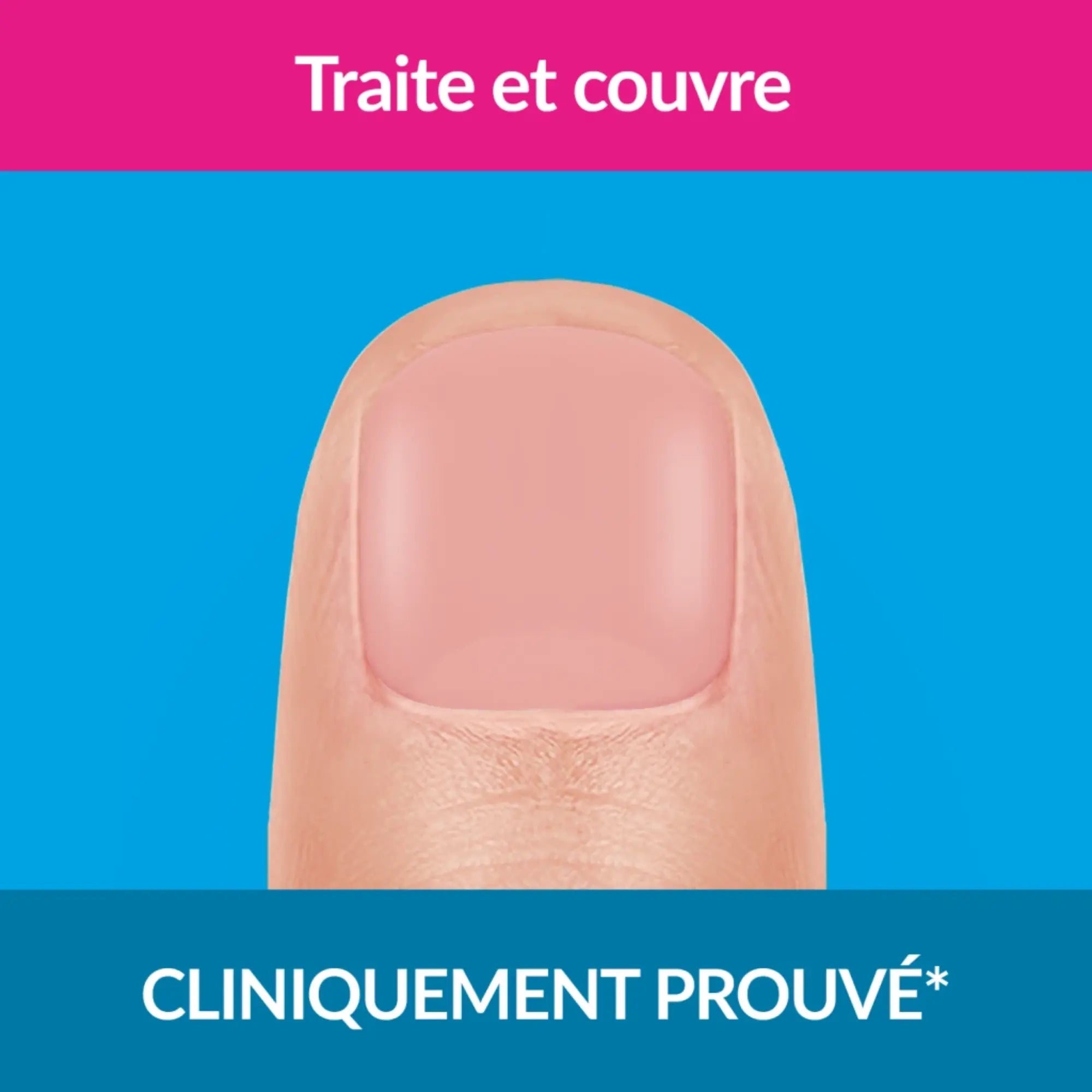 Traitement mycose ongles forte couleur nude 30ml - Excilor Excilor