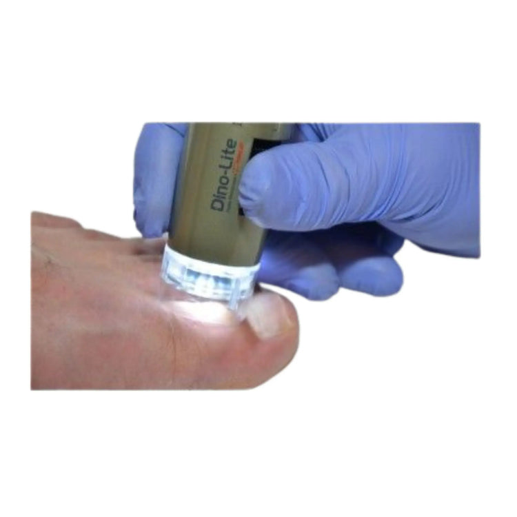 Ιατρικό Μικροσκόπιο - Ποδοσκόπιο 1,3 MP - Dino-Lite Dino-Lite 