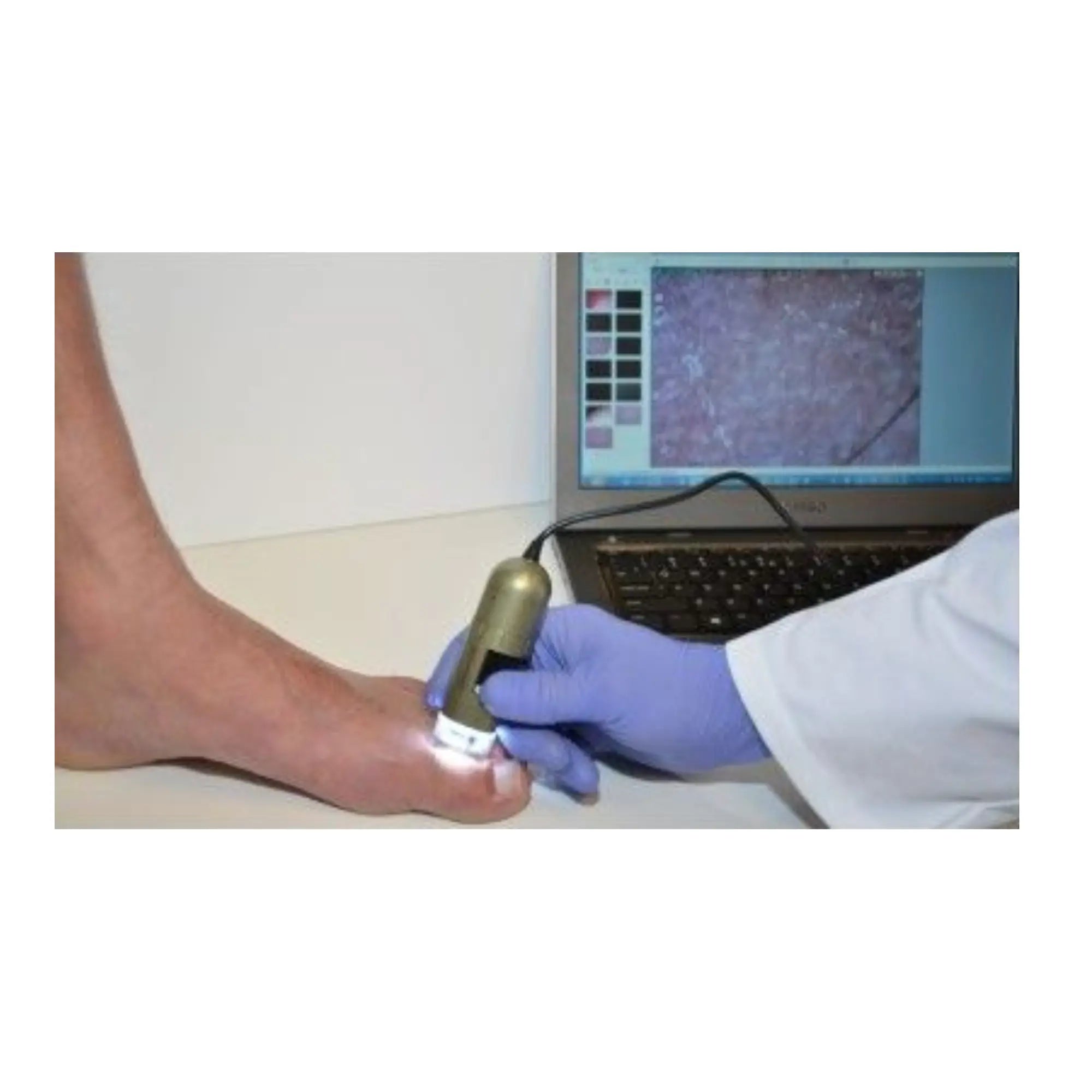 Ιατρικό Μικροσκόπιο - Ποδοσκόπιο 1,3 MP - Dino-Lite Dino-Lite 