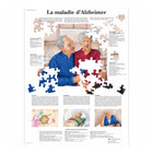 Ανατομικός πίνακας - Νόσος Alzheimer - Ανατομία και παθολογία