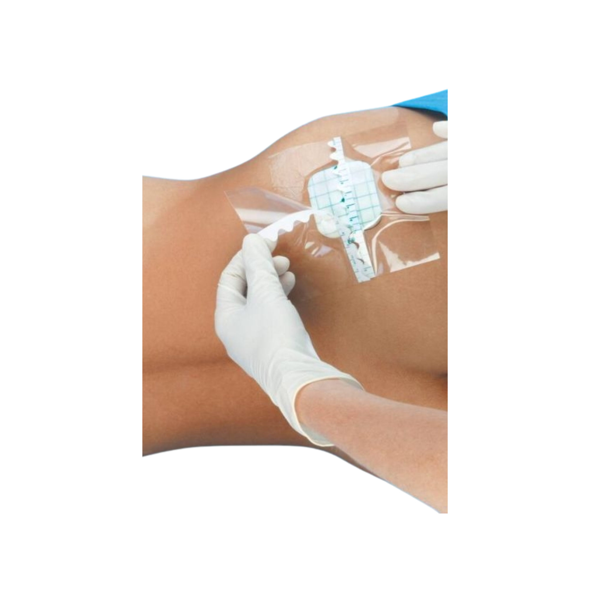 Rouleau de pansement adhésif Tegaderm Roll - 3M 3M 